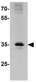 Anti-PHLP antibody used in Western Blot (WB). GTX31582