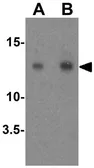Anti-GABARAPL2 antibody used in Western Blot (WB). GTX31584