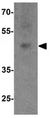 Anti-SOX18 antibody used in Western Blot (WB). GTX31587
