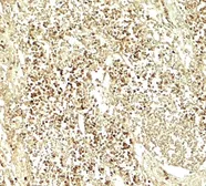 Anti-E2F3 antibody used in IHC (Paraffin sections) (IHC-P). GTX31589