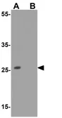 Anti-BAMBI antibody used in Western Blot (WB). GTX31590