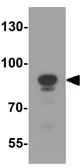 Anti-LIN54 antibody used in Western Blot (WB). GTX31591