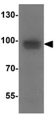 Anti-Rubicon antibody used in Western Blot (WB). GTX31593
