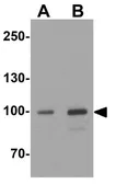 Anti-AKAP 82 antibody used in Western Blot (WB). GTX31595