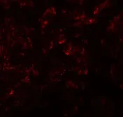 Anti-KIRREL2 antibody used in IHC (Paraffin sections) (IHC-P). GTX31598