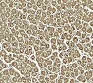 Anti-SKI2W antibody used in IHC (Paraffin sections) (IHC-P). GTX31599