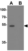 Anti-SESN2 antibody used in Western Blot (WB). GTX31602