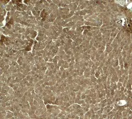 Anti-KLF17 antibody used in IHC (Paraffin sections) (IHC-P). GTX31603