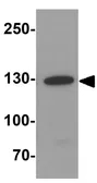 Anti-Jagged 1 antibody used in Western Blot (WB). GTX31607