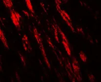 Anti-PJA1 antibody used in IHC (Paraffin sections) (IHC-P). GTX31608