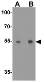 Anti-CRBN antibody used in Western Blot (WB). GTX31611
