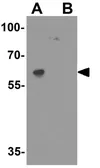 Anti-HELIOS antibody used in Western Blot (WB). GTX31612