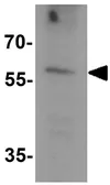 Anti-SLC29A4 antibody used in Western Blot (WB). GTX31614