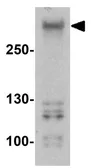 Anti-ODZ3 antibody used in Western Blot (WB). GTX31616