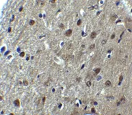 Anti-ARID1A antibody used in IHC (Paraffin sections) (IHC-P). GTX31619