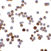 Anti-MAGEA4 antibody used in Immunocytochemistry/ Immunofluorescence (ICC/IF). GTX31620