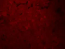 Anti-OATP2 antibody used in IHC (Paraffin sections) (IHC-P). GTX31621