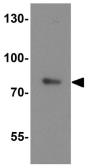 Anti-OATP2 antibody used in Western Blot (WB). GTX31621