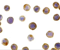 Anti-ICAD antibody used in Immunocytochemistry/ Immunofluorescence (ICC/IF). GTX31635