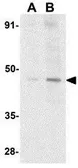 Anti-ICAD antibody used in Western Blot (WB). GTX31636