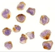 Anti-ASK1 antibody used in Immunocytochemistry/ Immunofluorescence (ICC/IF). GTX31637