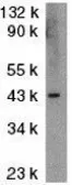 Anti-ICAD antibody used in Western Blot (WB). GTX31638