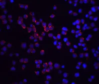 Anti-RIP2 antibody used in Immunocytochemistry/ Immunofluorescence (ICC/IF). GTX31644