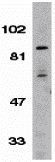Anti-IKK beta antibody used in Western Blot (WB). GTX31645