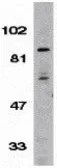 Anti-IKK beta antibody used in Western Blot (WB). GTX31645