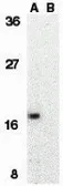Anti-Survivin antibody used in Western Blot (WB). GTX31652
