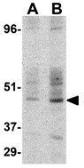 Anti-DC-SIGN antibody used in Western Blot (WB). GTX31656