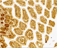 Anti-DC-SIGN antibody used in IHC (Paraffin sections) (IHC-P). GTX31657