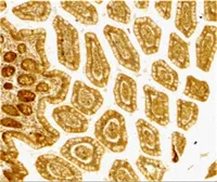 Anti-DC-SIGN antibody used in IHC (Paraffin sections) (IHC-P). GTX31657