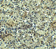 Anti-BCMA antibody used in IHC (Paraffin sections) (IHC-P). GTX31660