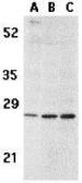 Anti-BCMA antibody used in Western Blot (WB). GTX31660