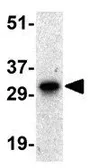 Anti-Livin antibody used in Western Blot (WB). GTX31663