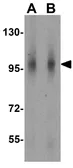 Anti-NOD2 antibody used in Western Blot (WB). GTX31664