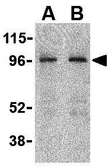 Anti-NOD2 antibody used in Western Blot (WB). GTX31665