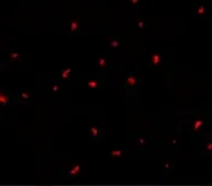 Anti-PAK6 antibody used in Immunocytochemistry/ Immunofluorescence (ICC/IF). GTX31672
