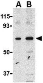 Anti-PAK4 antibody used in Western Blot (WB). GTX31673