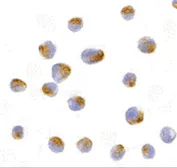 Anti-BCL2L10 antibody used in Immunocytochemistry/ Immunofluorescence (ICC/IF). GTX31677