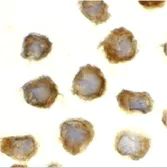 Anti-TLR11 antibody used in Immunocytochemistry/ Immunofluorescence (ICC/IF). GTX31683
