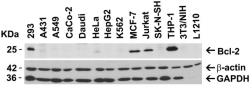 Anti-Bcl-2 antibody used in Western Blot (WB). GTX31687