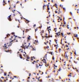 Anti-Bid antibody used in IHC (Paraffin sections) (IHC-P). GTX31689