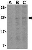 Anti-Bid antibody used in Western Blot (WB). GTX31690