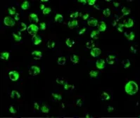 Anti-IRF8 antibody used in Immunocytochemistry/ Immunofluorescence (ICC/IF). GTX31696