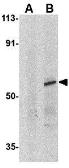 Anti-IRF8 antibody used in Western Blot (WB). GTX31696
