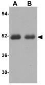 Anti-Caspase 2 antibody used in Western Blot (WB). GTX31699
