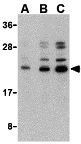Anti-Caspase 6 antibody used in Western Blot (WB). GTX31707