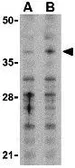 Anti-MCL1 antibody used in Western Blot (WB). GTX31709